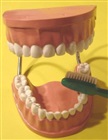 Model of dentures