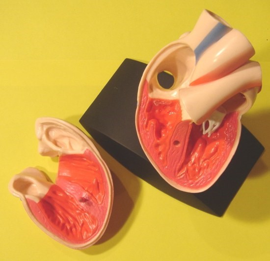 Sectional heart Sectional heart
